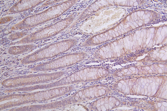 GLA Recombinant Monoclonal Antibody
