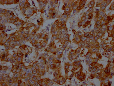 S100A9 Antibody