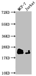 MGMT Antibody