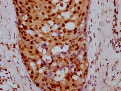 CCNE1 Antibody