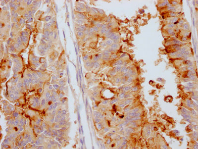 MUC16 Antibody