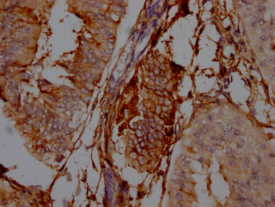 NT5E Antibody