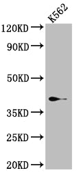 SAE1 Antibody