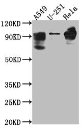 PDE4D Antibody