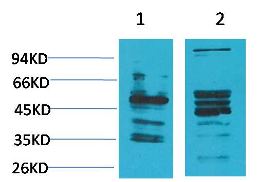 NMBR (Bombesin Receptor 1) Rabbit pAb