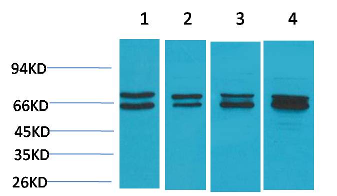Estrogen Receptor α Rabbit pAb