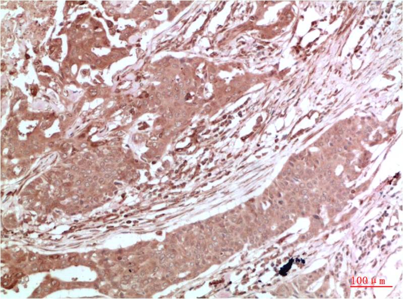 AMPK α2 Rabbit pAb