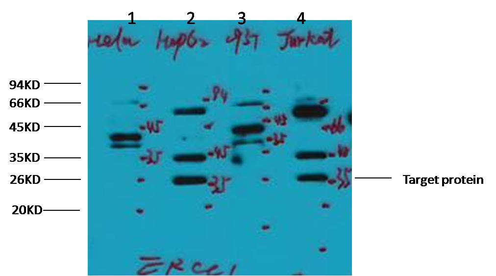 ERCC1 Mouse mAb