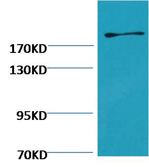 Fibronectin Mouse mAb
