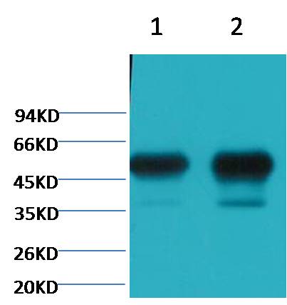 β II tubulin Mouse mAb