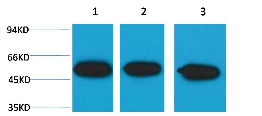β III tubulin Mouse mAb