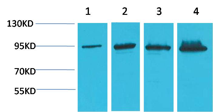 β-Catenin Mouse mAb
