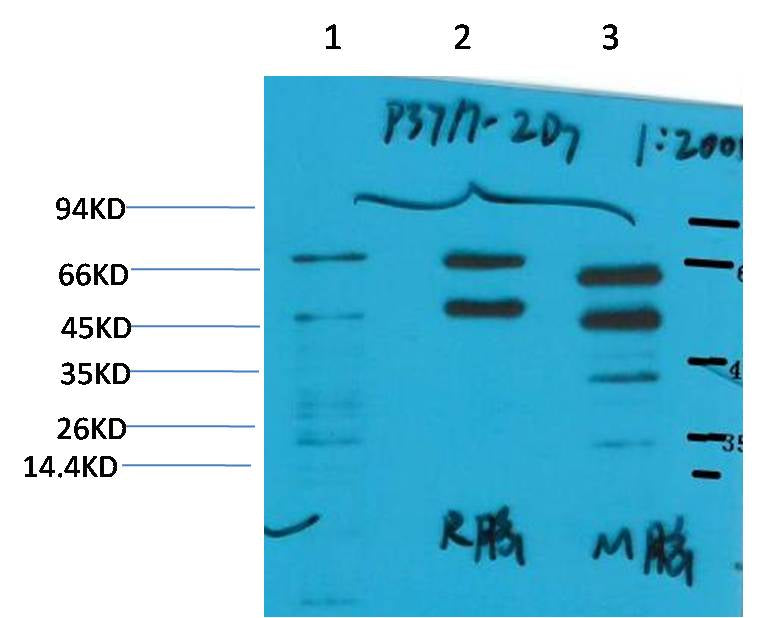 Phosphoserine Mouse mAb