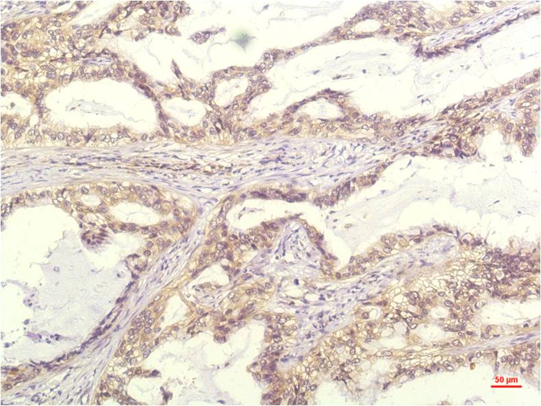 IL-8 (13F8) Mouse mAb