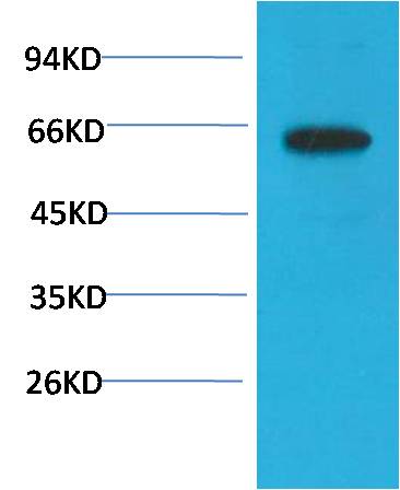 Phospho-Akt (S473) (6F8) Mouse mAb