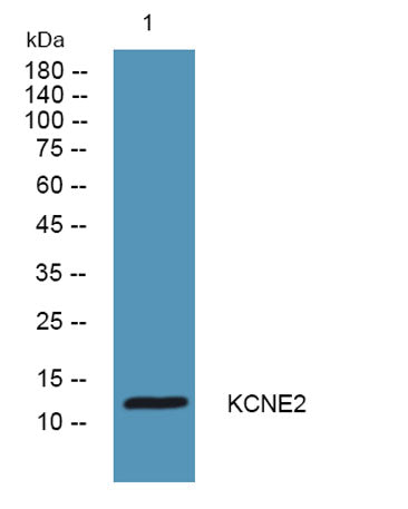 KCNE2 rabbit pAb