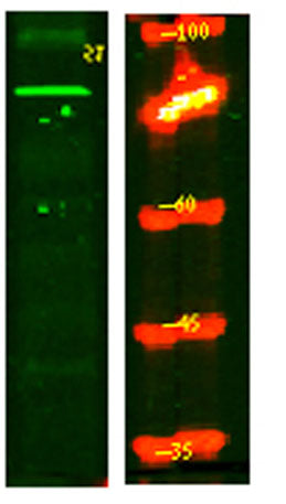 PPM1E rabbit pAb