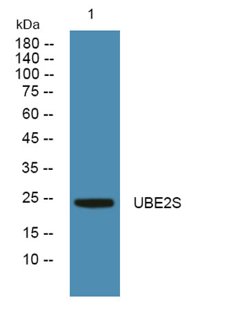 UBE2S rabbit pAb