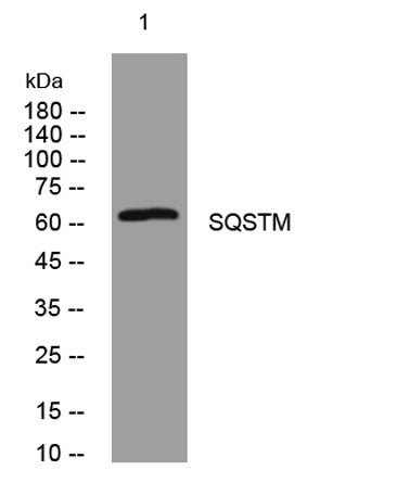 SQSTM1/p62 rabbit pAb