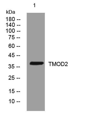 TMOD2 rabbit pAb