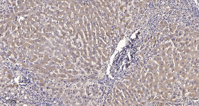 Tie2 (phospho-Ser1119) rabbit pAb