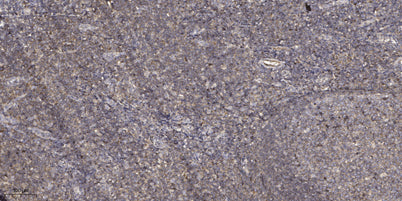 Thrombospondin 1 rabbit pAb
