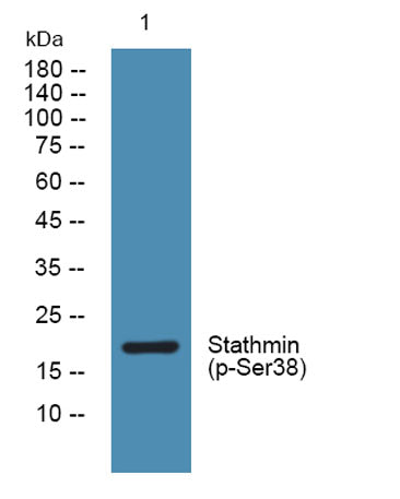 Stathmin (phospho-Ser38) rabbit pAb