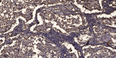 SPR2D rabbit pAb