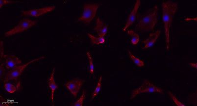 eIF2α (phospho Ser51) rabbit pAb