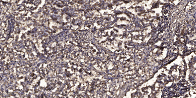 SLP-76 (phospho-Ser376) rabbit pAb