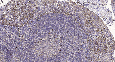 SCN1A rabbit pAb