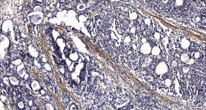 REPS1 (phospho-Ser709) rabbit pAb