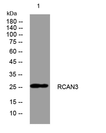 RCAN3 rabbit pAb