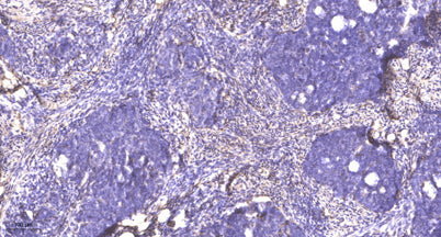 RanBP3 (phospho-Ser58) rabbit pAb
