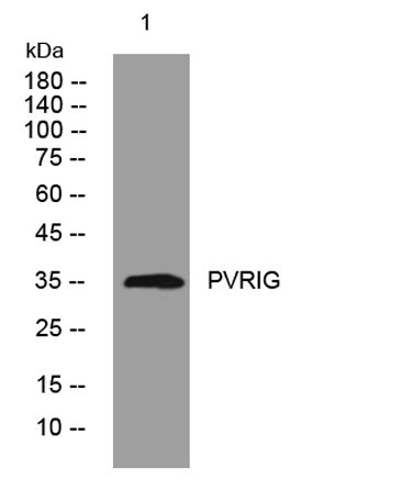 PVRIG rabbit pAb