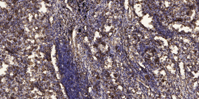 PSD95 (phospho-Ser295) rabbit pAb