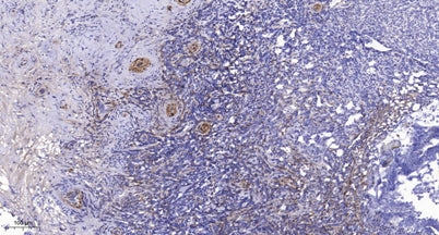 PRK1 (phospho-Thr774)/PRK2 (phospho-Thr816) rabbit pAb