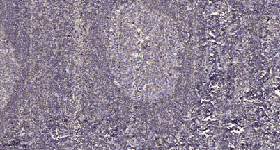 PNK1 (phospho-Ser114/Thr118) rabbit pAb