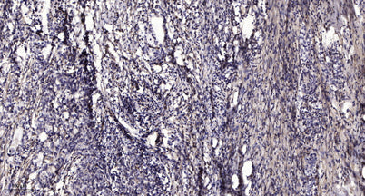 PLCγ2 (phospho-Tyr759) rabbit pAb