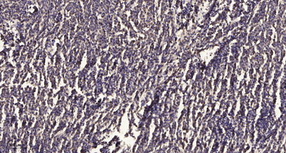 PKCα/β II (phospho-Thr638/641) rabbit pAb
