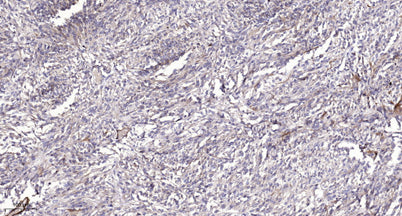 PI3 Kinase Class III (phospho-Ser249) rabbit pAb