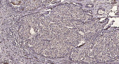 PDGF Receptor β (phospho-Tyr1009) rabbit pAb