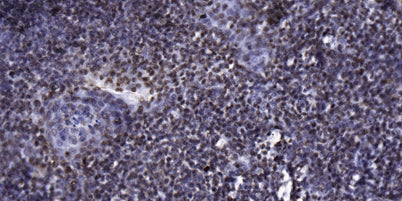 p70 S6 Kinase (phospho-Thr389) rabbit pAb