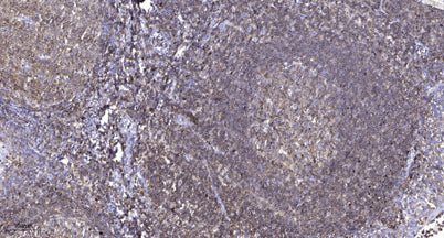 OCT1 Monoclonal Rabbit pAb