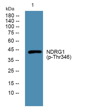 NDRG1 (phospho-Thr346) rabbit pAb