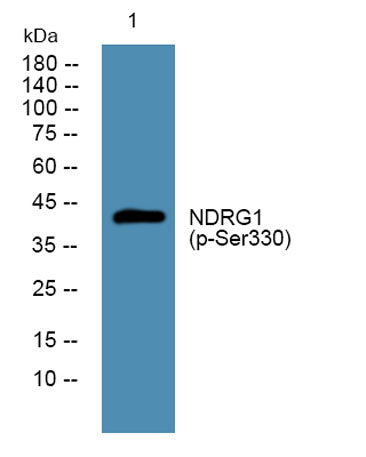 NDRG1 (phospho-Ser330) rabbit pAb