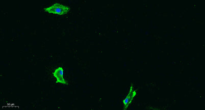 Flt-1 (phospho Tyr1333) rabbit pAb