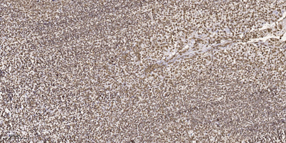 MOK (Phospho-Tyr161) rabbit pAb