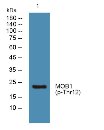 MOB1 (phospho-Thr12) rabbit pAb