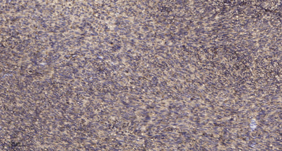 Met (phospho-Tyr1234/1235) rabbit pAb